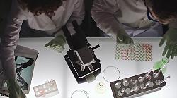 Chiarito il legame tra lupus e rischi cardiovascolari