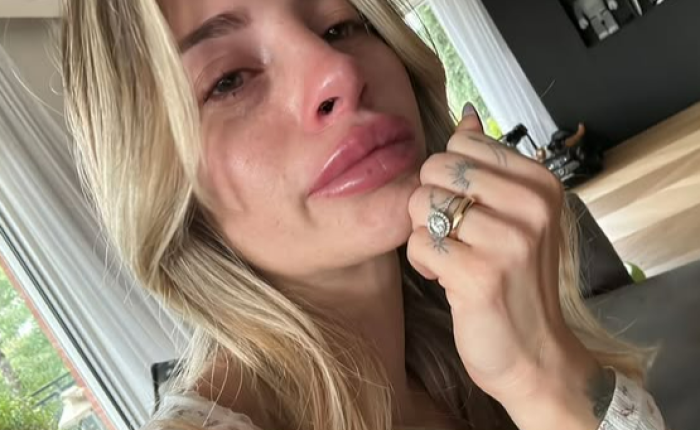 Chiara Nasti, le foto in lacrime per raccontare la sua sofferenza : "A un certo punto il buio. Non dormivo mai, ero sfinita e inventavo dolori"